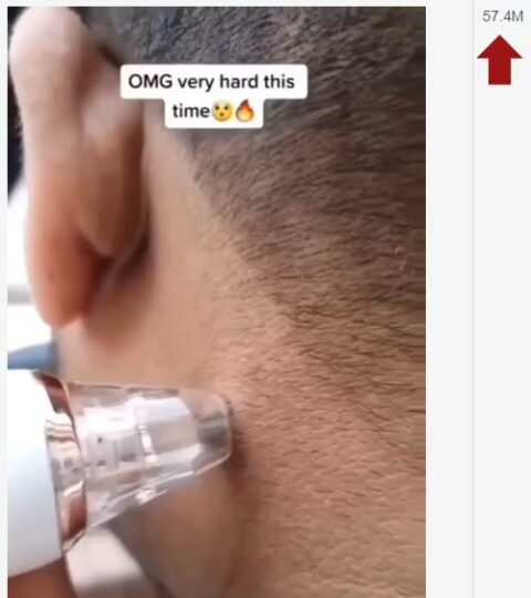 Facebook video of a man pulling a mole on his neck